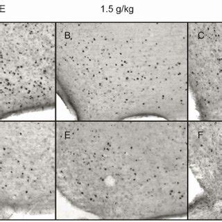 Representative photomicrographs of 50 μ m coronal sections showing ... 