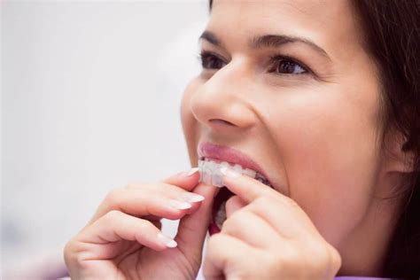 Braces Vs Invisalign Choosing The Right Option