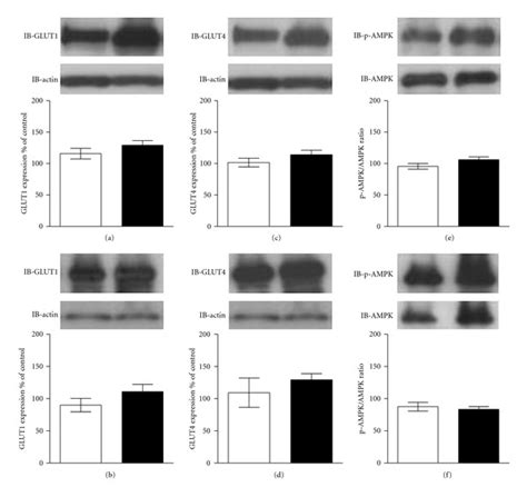 Western Blotting Analysis Of Glut1 And Glut4 Contents And The