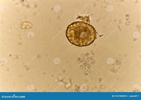 Egg Of Ascaris Lumbricoides In Human Stool Stock Image Image Of