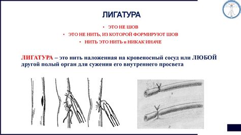 Узлы в хирургии - презентация онлайн