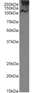 MUC1 Antibody SM3 Rabbit IgG ProSci Incorporated