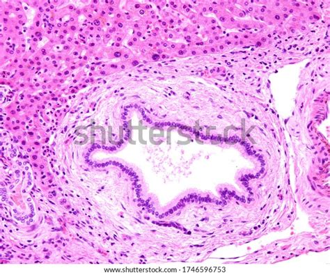 695 Bile Ducts Stock Photos Images And Photography Shutterstock