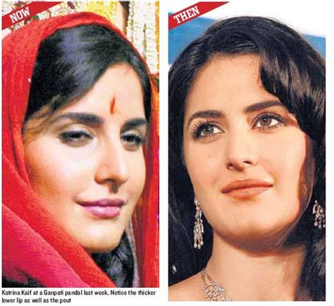 Katrina Kaif Plastic Surgery