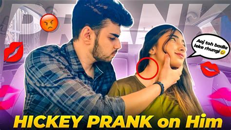 Hickey Lovebite💋 Prank On Bestfriend He Called My Mom😭 Revenge