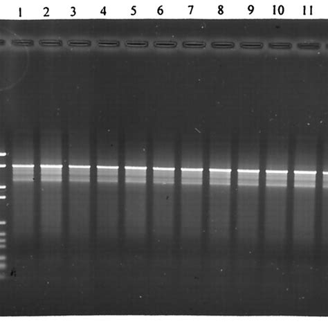 Representative Eric Pcr Patterns Of Clinical Isolates Of E