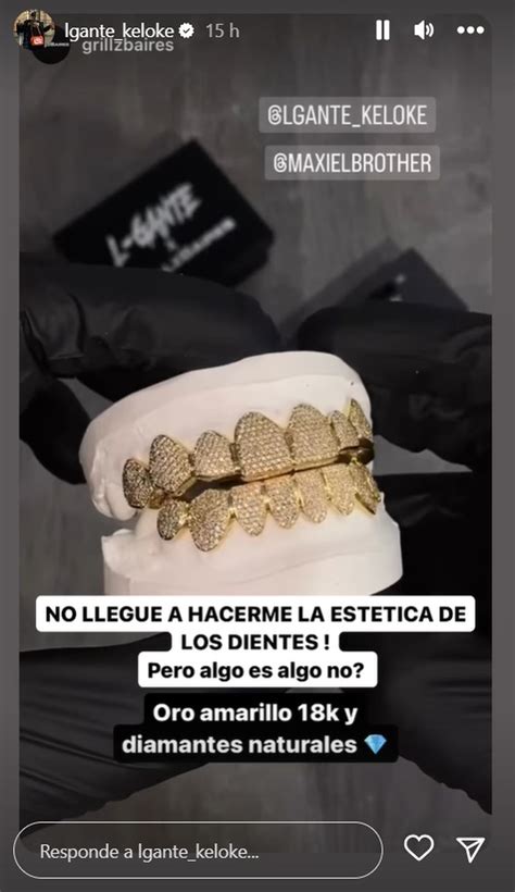 L Gante mostró su impactante nueva dentadura de oro y diamantes