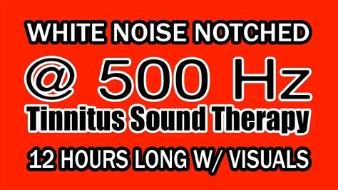 White Noise Notch Filtered At Hz For Tinnitus Therapy W Visuals