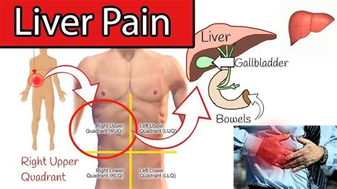 Abdominal Pain Causes: The Upper Stomach Trick And Examples, 57% OFF