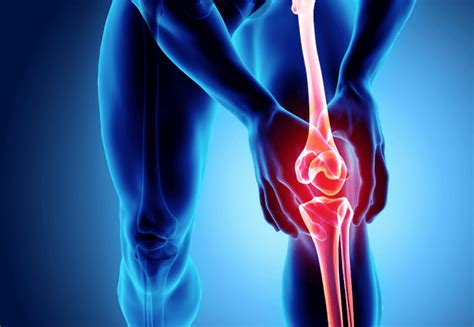 Osteoartrit Nedir Osteoartrit Belirtisi Ve Tedavisi EdoktorTV