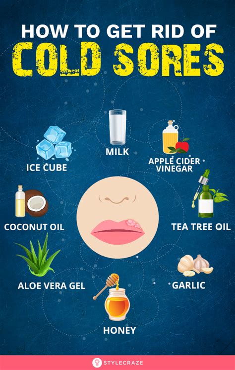 20 Home Remedies To Get Rid Of Cold Sores And Prevention Tips Cold Sore Remedy Overnight Cold