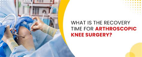 What’s The Recovery Time For Arthroscopic Knee Surgery