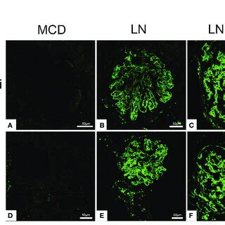 Frozen Sections For C4d Using Immunofluorescence Among MCD A D LN