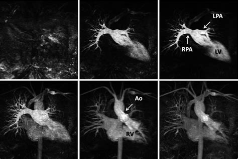 Magnetic Resonance Angiography Radiology Key