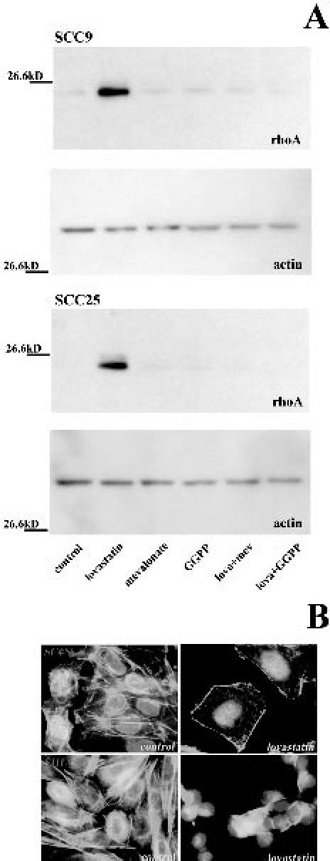 A Western Blot Analysis Of Rhoa And Actin In Scc9 And Scc25 Cells