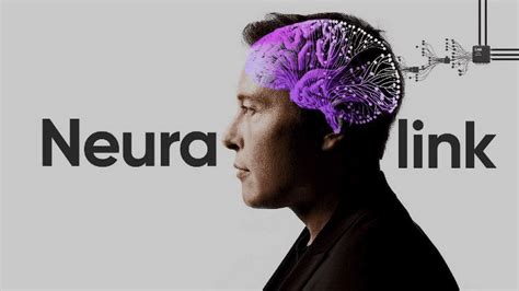 Elon Musk Adia Para Novembro Apresentação Do Neuralink