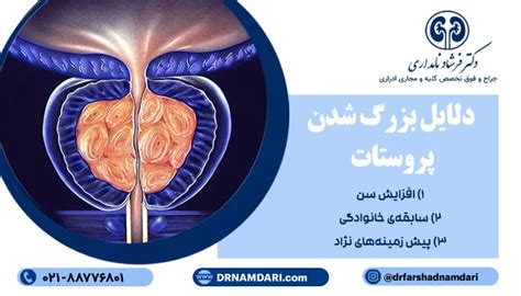 رایج ترین و جدیدترین درمان بزرگی پروستات بدون جراحی درمان هیپرتروفی