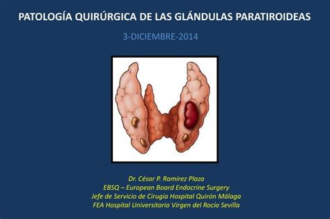 Clase Patologia Quirurgica Paratiroides Ppt