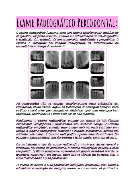 Exame Radiográfico Periodontal Exame Radiográfico Periodontal O