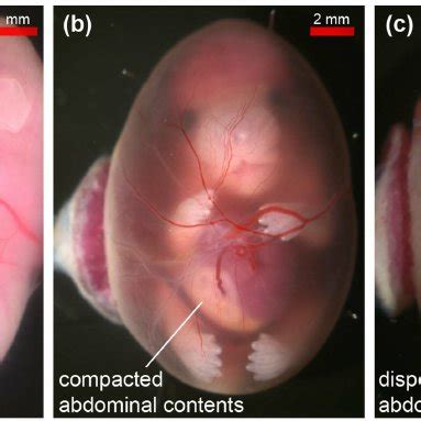 Coronal Sections Of In Amnio Mouse Embryo Mr Images At E A