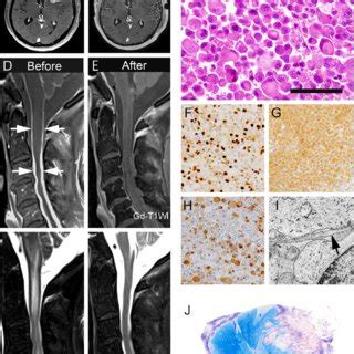 Clinicopathologic Features Of The Patient Preoperative A And