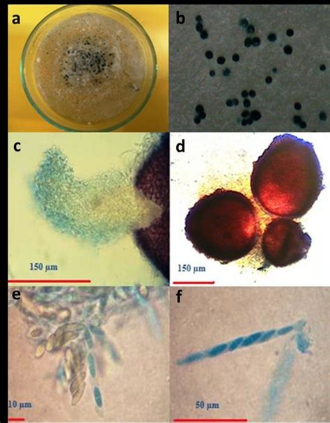 Fusarium Proliferatum A C Perithecia Of Formed From Crossing Between