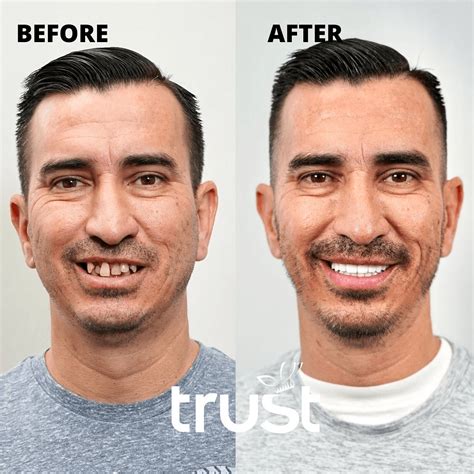 Trust Implants Remarkable Dental Implants In Indian Wells 1 Rated