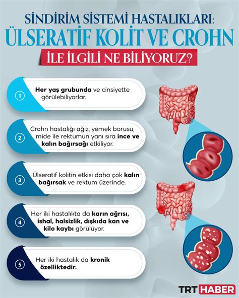 Lseratif Kolit Ve Crohn Hastal Ihmale Gelmiyor Son Dakika Haberleri