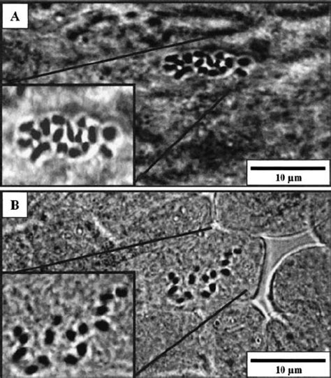 Root Tip Cells From Two Polyembryonic Seedlings Showing A Diploid