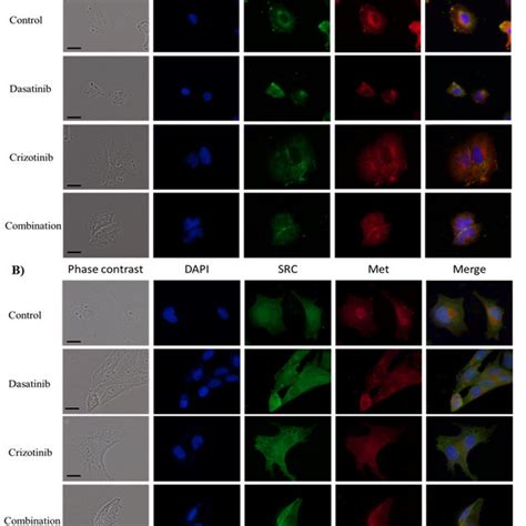 Immunocytochemistry Of Src And Met Localization Cellular Localization