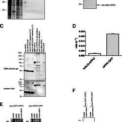 Eukaryotic Hppo Expression Purification And Enzymatic Activity