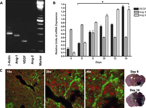 The Temporal Expression Of Vegf Ang And Ang By The Glioma A