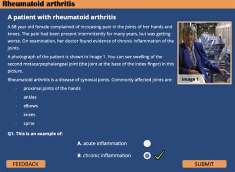 Rheumatoid Arthritis Flashcards Quizlet