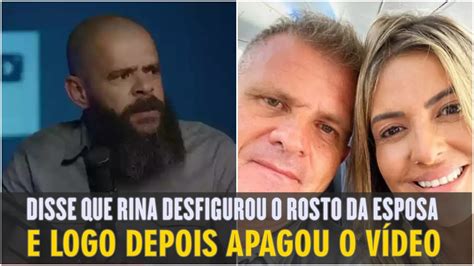 Anderson Silva Apaga V Deo Ap S Dizer Que Apostolo Rina Desfigurou O