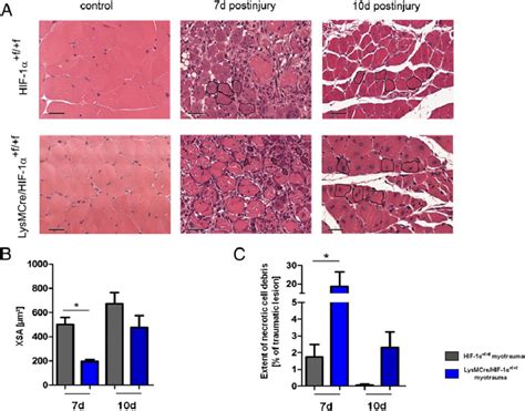 Muscles Of LysMCre HIF 1a F F Mice Were Characterized By Lower XSAs