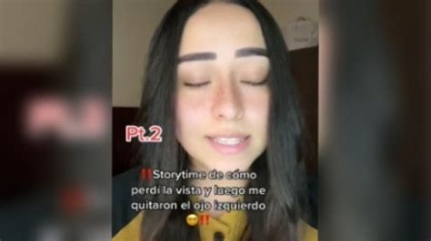 Joven Revela Cómo Perdió La Vista Y Le Sacaron Un Ojo Ya Es Viral En