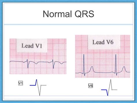 Normal ecg interpretation