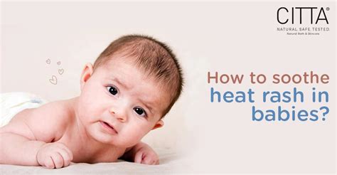 How to treat heat rash in babies? - CITTA