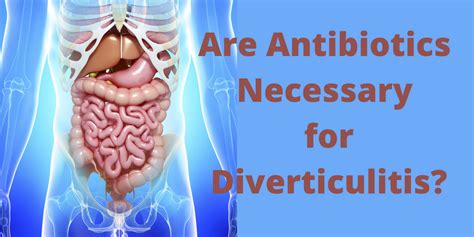 The Functional Medicine Approach To Diverticulitis