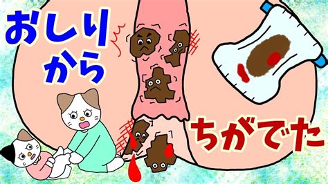 【アニメ絵本 読み聞かせ】恥ずかしいけどお尻の病院へ行ってみた絵本〜痔の絵本〜おしりから血が出た〜 Youtube