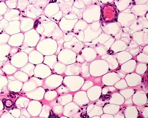 Adipose Tissue Under Microscope