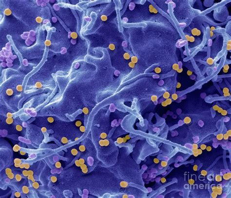 Hiv Infected Cell Photograph By Steve Gschmeissner Science Photo Library Fine Art America