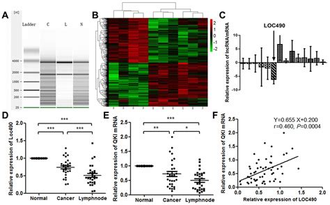 Long Non Coding RNA Loc490 Inhibits Gastric Cancer Cell Proliferation