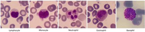 Five types of white blood cells in the normal peripheral blood ...