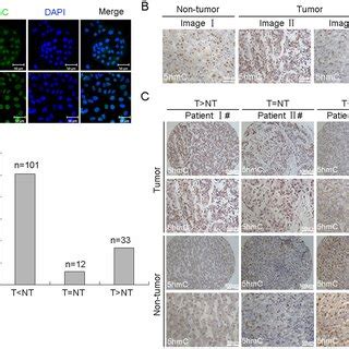 Expression Of Tet In Hcc And Non Tumor Tissues A The Protein