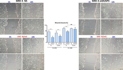 Cell Migration Assays Of Normal MRC 5 Cells With Or Without Genotoxic