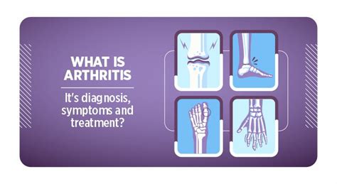 Arthritis; Diagnosis, Symptoms, & Treatment | Accord Hospital