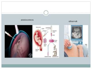 Geneticko Savjetovanje I Rano Otkrivanje Nasljednih Bolesti PPT