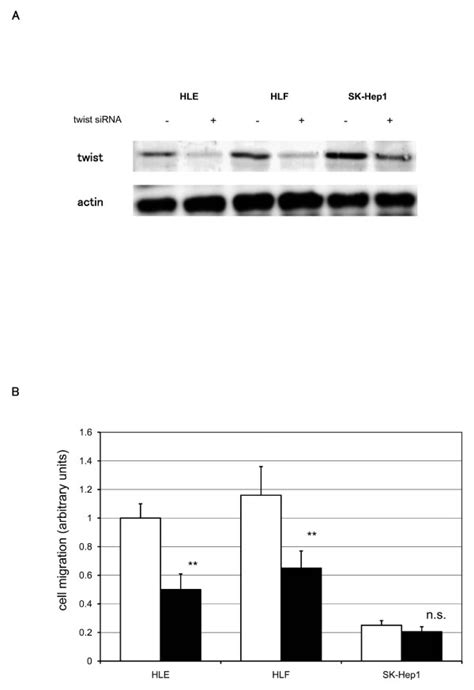 Effect Of Gene Silencing Using Twist Sirna On Cell Migration A After