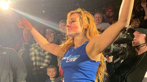 What Injuries Becky Lynch Actually Suffered